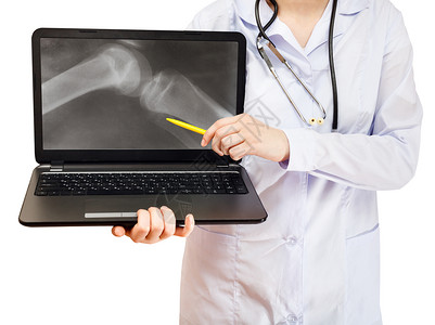 计算机膝上电脑手提的护士点用X光照片拍摄白底隔离的屏幕上人体膝关节图片