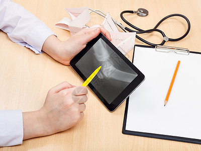 医生平板医生检查平板电脑上的人类膝关节X光照片背景