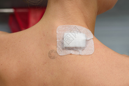 医疗补丁贴在女孩颈部的伤口上图片