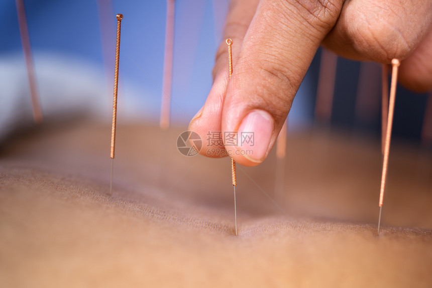 在针管治疗过程中用钢针头对老年女进行缝针检查图片