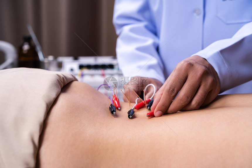 近身妇女接受背有电动脉器的针孔切除治疗图片