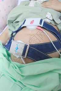 对怀孕母亲在流产时的心功能婴儿监测工具图片