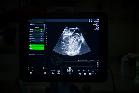 cv4d4D图象的超声波医疗机在LABOR和医院产房背景