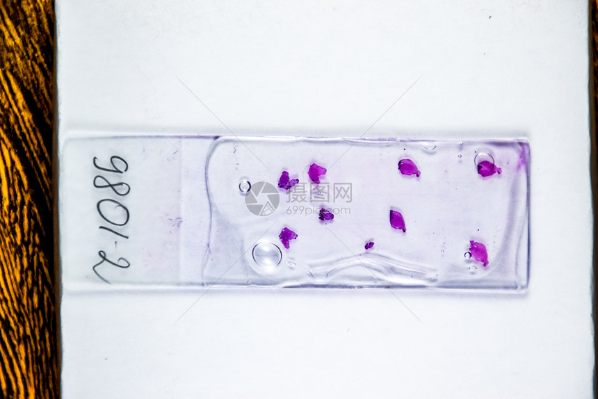 玻璃下肿瘤的切片对细胞进行生理学检查以发现癌症在灯底部的渗漏下肿瘤细胞样本对肿瘤细胞进行生理学检查以发现癌症图片