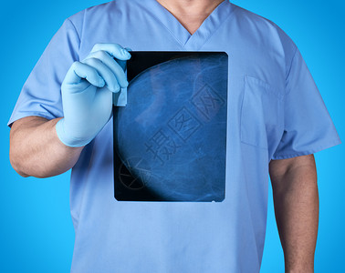 戴蓝色制服和乳胶手套医生的蓝色制服和乳胶手套持病人乳腺X光X照片图片