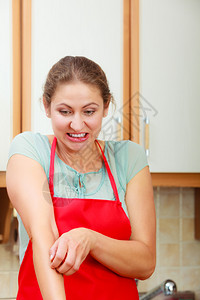 成年女人用过敏皮疹抓痒的手臂厨房里有女压力人抓痒手臂过敏图片