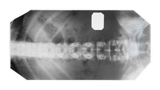 白色背景上隔离的人类脊椎前视图的X光胶片像图片