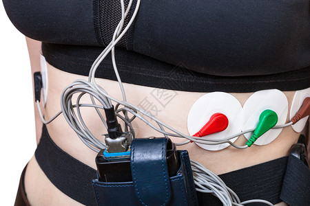 心电图的霍尔特监测器传感和记录附于女躯体背景
