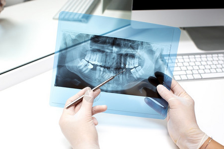 牙医分析X光照片审查牙科专业的图片