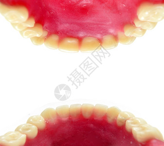 牙科假牙模具图片