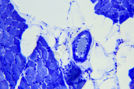 条纹的细胞显微镜下骨骼肌肉组织纵轴部骨骼肌肉LS组织学图片