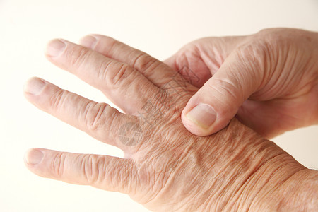 高年男子按摩关节的疼痛手指皮肤图片