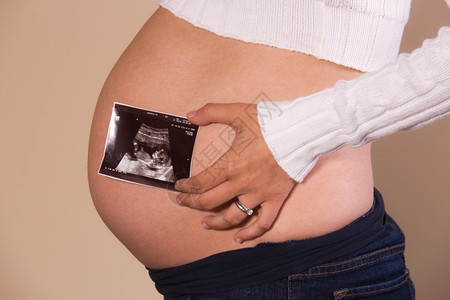 淑女母亲庄稼孕妇在其的肚子上贴有超声波照片图片