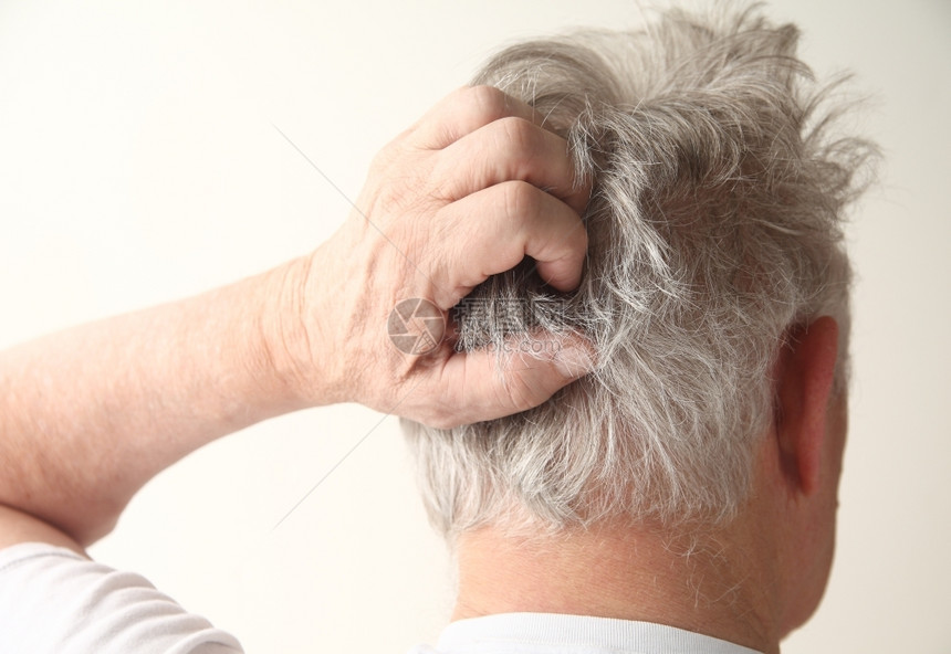 年纪大的男人头皮很烦年长的头发手图片