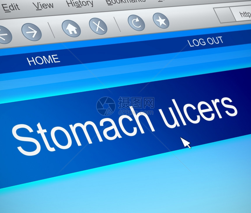 网站胃肠道一种显示带有胃溃疡概念的计算机屏幕捕捉图示I说明图片