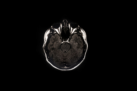 测试技术脑扫描X光成像磁的图片