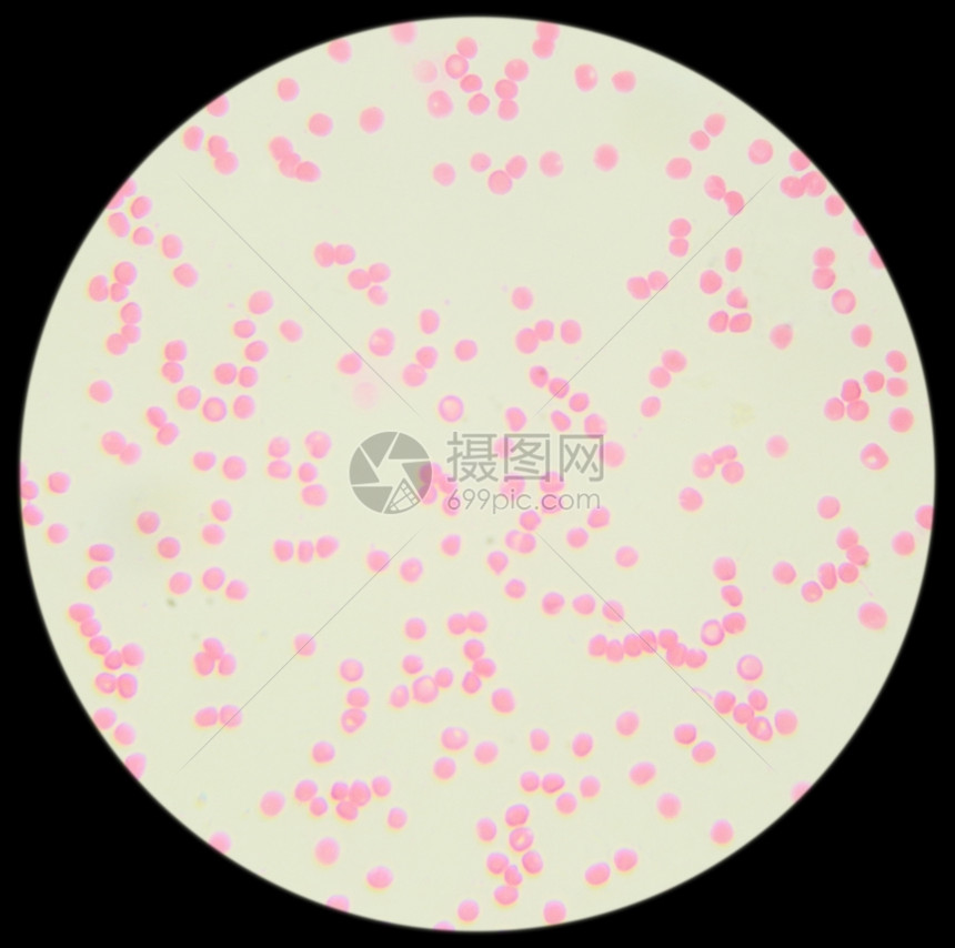 免疫学中粒细胞实验室在显微镜下的人类血液迹图片
