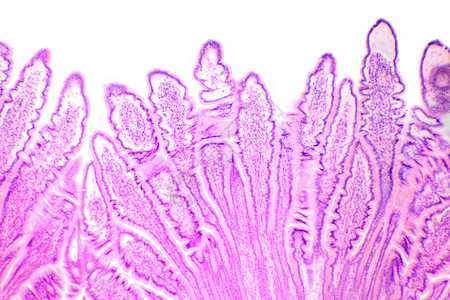 显微镜下小肠子的玫瑰剖面小胸腔微观的系统医疗图片