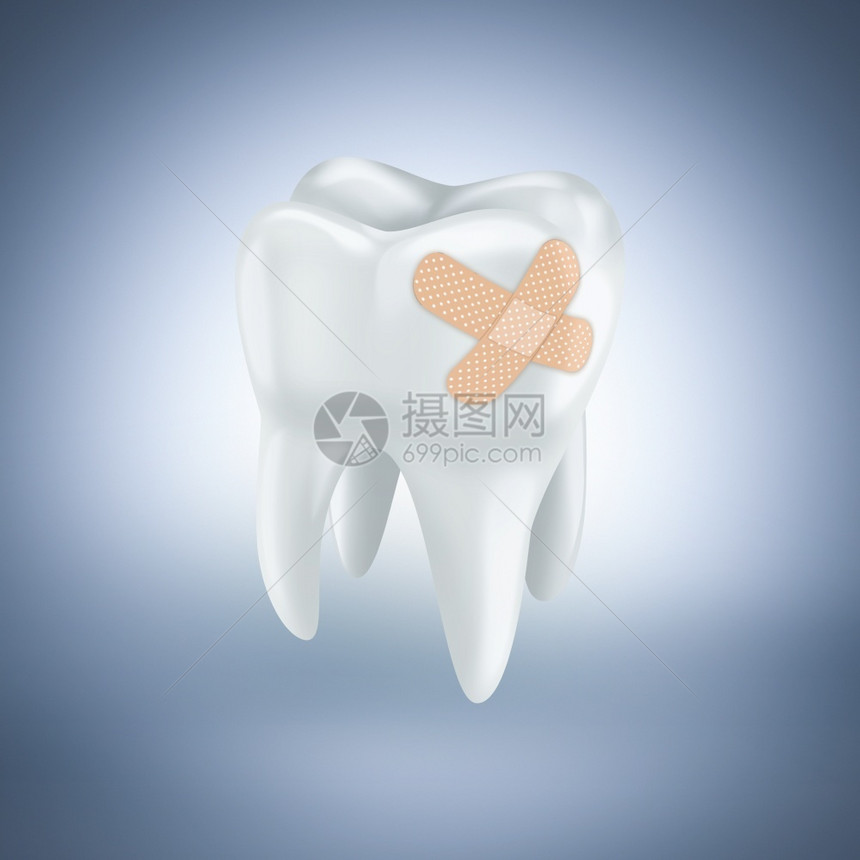在浅蓝色背景上涂有石膏的牙齿桥医卫生图片