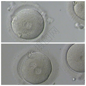 基因人类体外受精子生殖背景图片