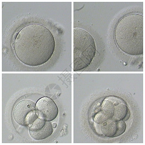 不育显微镜医疗的人类体外受精基因设计图片