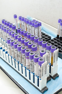 血性团体许多测试管正在对捐献者血液进行检测贴纸考试背景