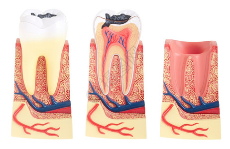 纸浆白底隔离的重要牙齿结构骨骼颈部和套接塞以白色背景隔离牙医衰变胶设计图片