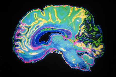 人工智呢精神的磁人脑工彩色核磁共振成像仪扫描水平的设计图片