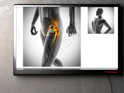 医疗的膝盖X射线扫描X光图像科学图片