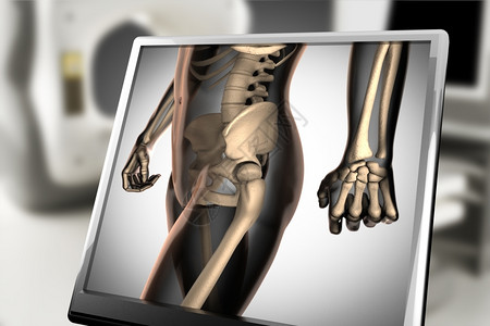 肋骨参加X射线扫描X光图像黑色的图片