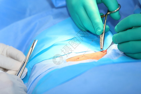 医生在手术室缝线的宏观片集工具中的焦点Focusinthetools手套房间重点图片