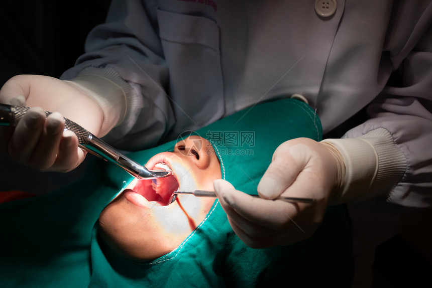 牙医正在给病人治疗牙齿图片