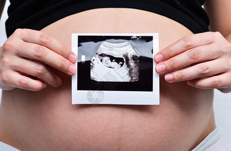 人们孕妇展示超声波期待的水平图片