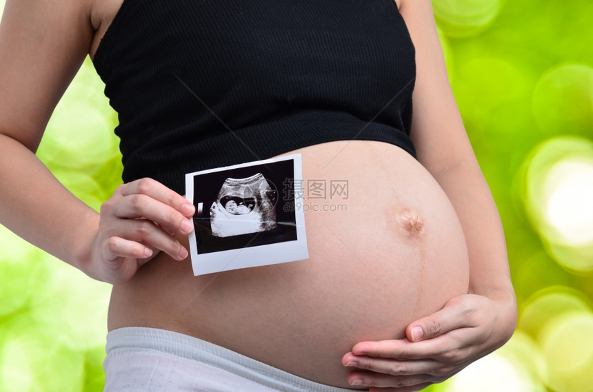 家庭白种人考试孕妇在绿色bokeh抽象光背景上展示超声波图片