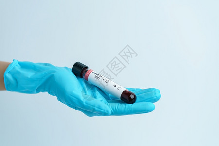 手与蓝色套握有COVID19冠状血样测试管本的蓝手套药物科学实验图片