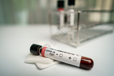 微生物学实验室Corona测试CCOVID19科罗纳的血样检验本图片