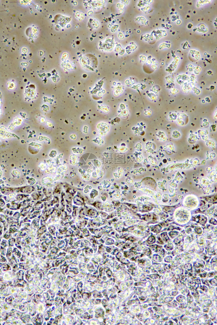 医疗的疾病细胞器Colon癌症细胞在组织培养中的显微镜示墙壁核心和器官图片