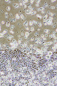 复发医疗的疾病细胞器Colon癌症细胞在组织培养中的显微镜示墙壁核心和器官设计图片