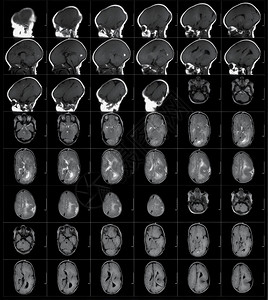 解剖学病人医疗的MRI人体头部扫描图片