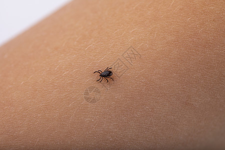 皮肤螨虫跑黑滴子在人体皮肤上运行并寻找咬和病原体传播的空间哺乳动物危险的背景