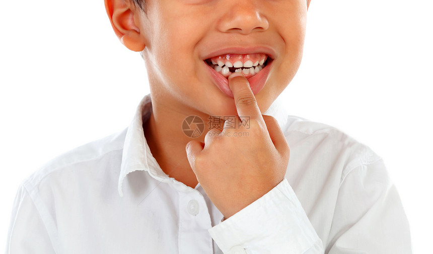 病人嘴年轻的白种背景利特男孩展示他的牙齿被孤立图片