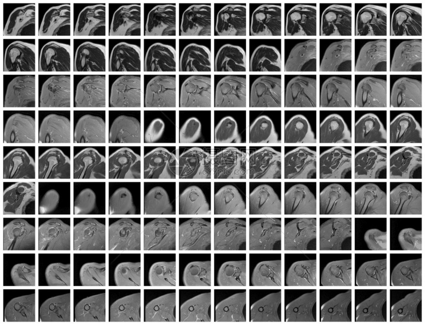 医院射线磁的右肩关节全共振图片