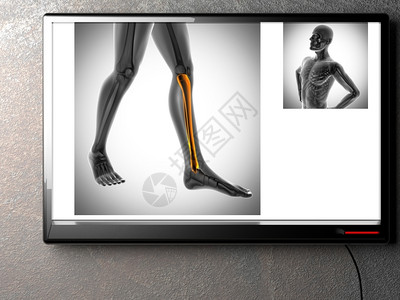 x型腿辐射X线扫描X光图像人类肋骨设计图片