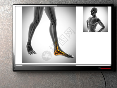 x型腿肋骨解剖学X射线扫描X光图像放射学设计图片