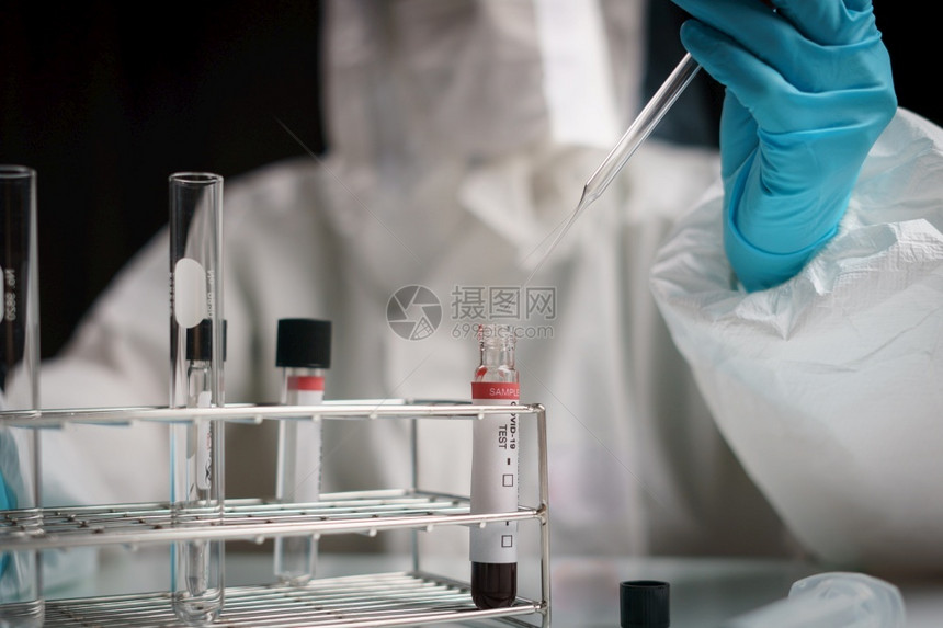 Corona测试过程手握血液检测样本中的输管滴化学溶液成套工具微生物学家危害图片