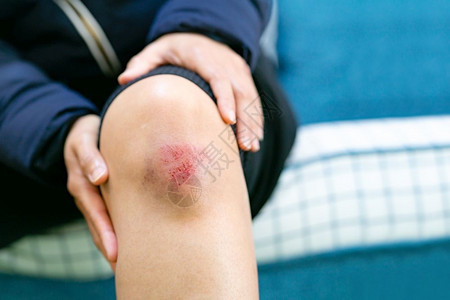 膝盖受伤的男性背景图片