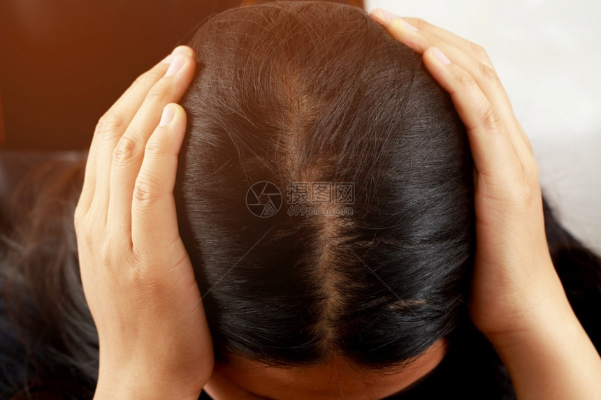 女人的发型有问题女落下损失图片