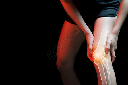 肌肉学遭受联合的医疗学概念膝盖疼痛的妇女骨骼X光背景