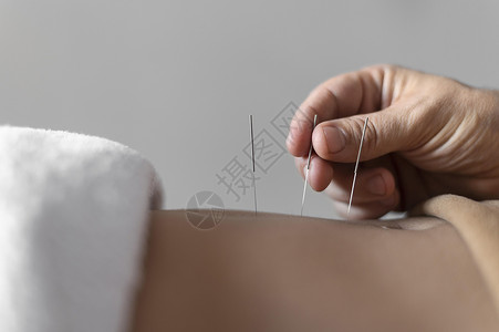治愈性插画男人药物身体近手针灸分辨率和高品质美图手针特写高品质美图概念背景