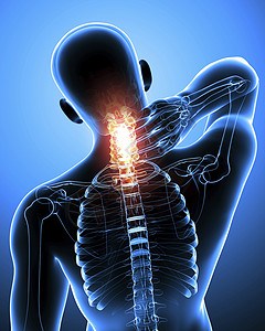 肌肉紧张3d男颈部疼痛蓝色紧张的宫颈颅骶设计图片